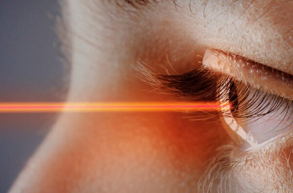 λέιζερ στα μάτια για διαθλαστικές ανωμαλίες: μυωπία, υπερμετρωπία, αστιγματισμός και πρεσβυωπία.