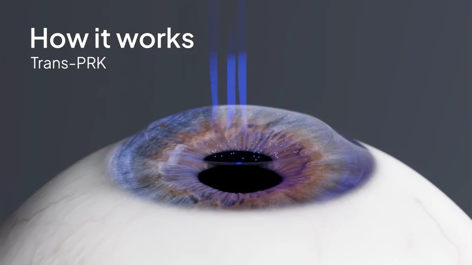 Τι είναι η τεχνική PRK