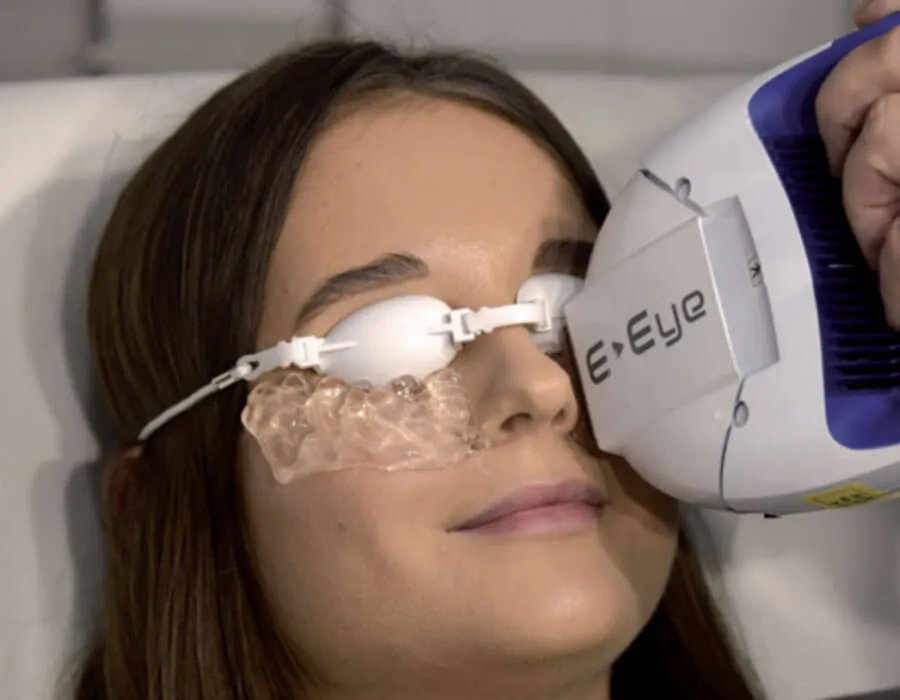 Μέθοδος αντιμετώπισης της βλεφαρίτιδας