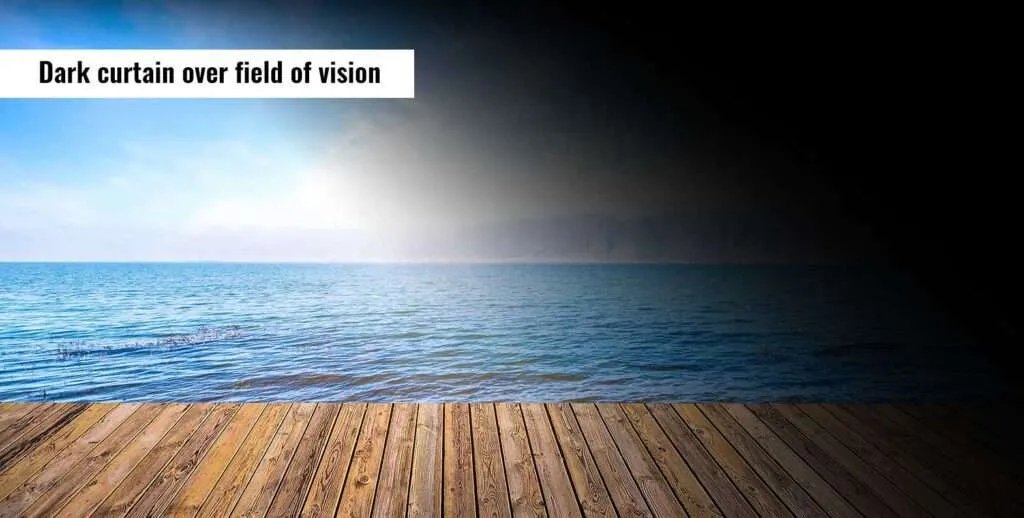 Διαγραμματική απεικόνιση αποκόλλησης αμφιβληστροειδούς και συμπτώματα προειδοποίησης.