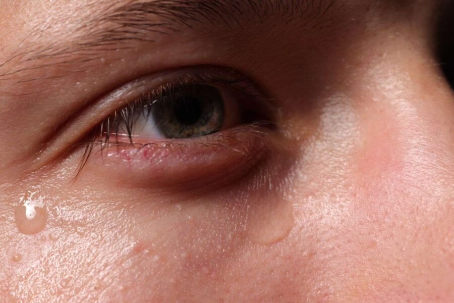 Μυοκυμία: Γιατί παίζει το μάτι μου