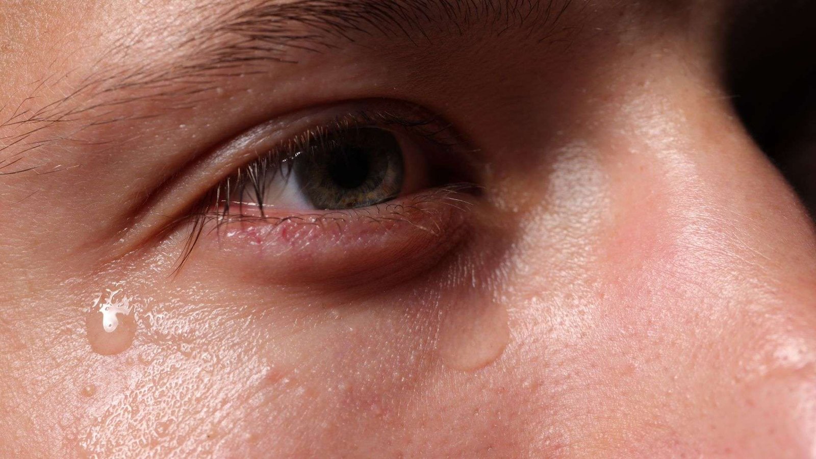 Μυοκυμία: Γιατί παίζει το μάτι μου