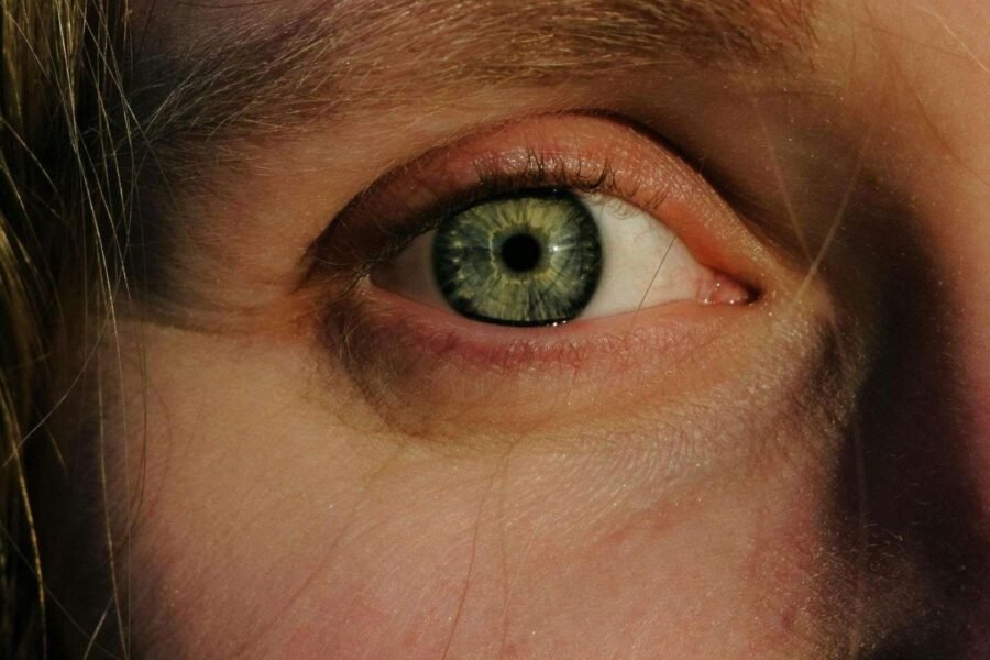 Πρησμένα μάτια