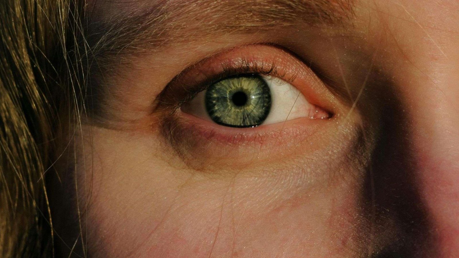 Πρησμένα μάτια