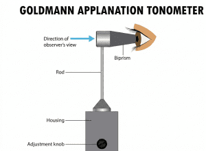 Το τονόμετρο Goldmann: H κεφαλή του τονομέτρου ακουμπά και επιπεδώνει τον κερατοειδή παρέχοντας ακριβή μέτρηση της ενδοφθάλμιας πίεσης.